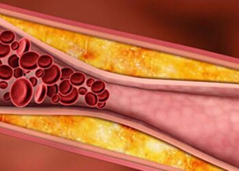 Punya Kolesterol Tinggi tapi Malas Minum Obat, Berikut jenis Makanan yang bisa Menurunkan Kolesterol, Yuk Simak!