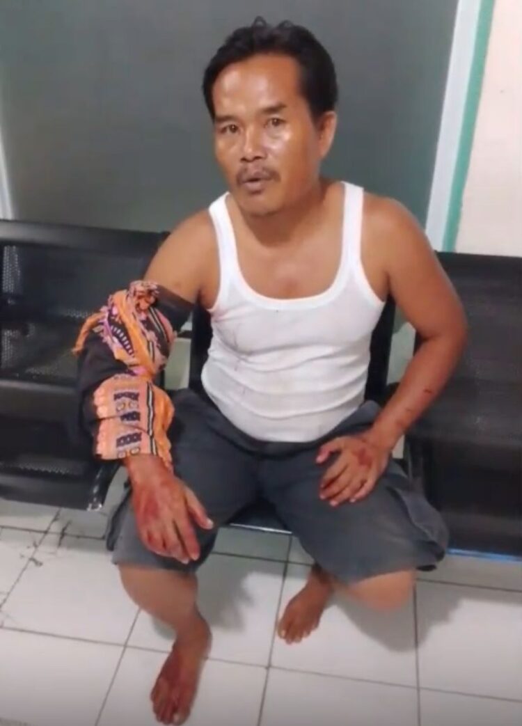 Habis Berkunjung Kerumah Teman, Seorang Pria Jadi Korban Begal di Nambo, Klapanunggal